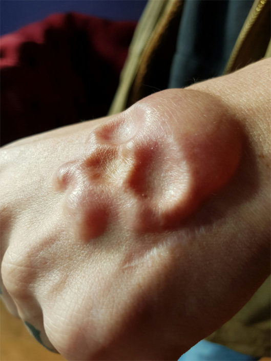 Bodymodification Stigmata Inc (5) - Stigmata-Inc.